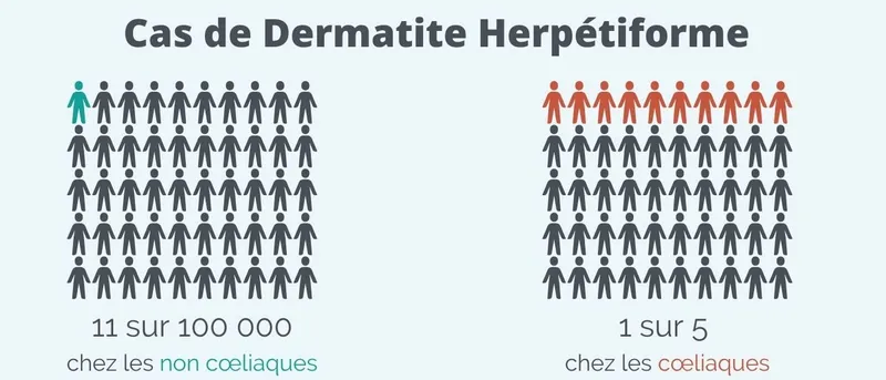 chiffres copnsequences maladie coeliaque (3).jpg